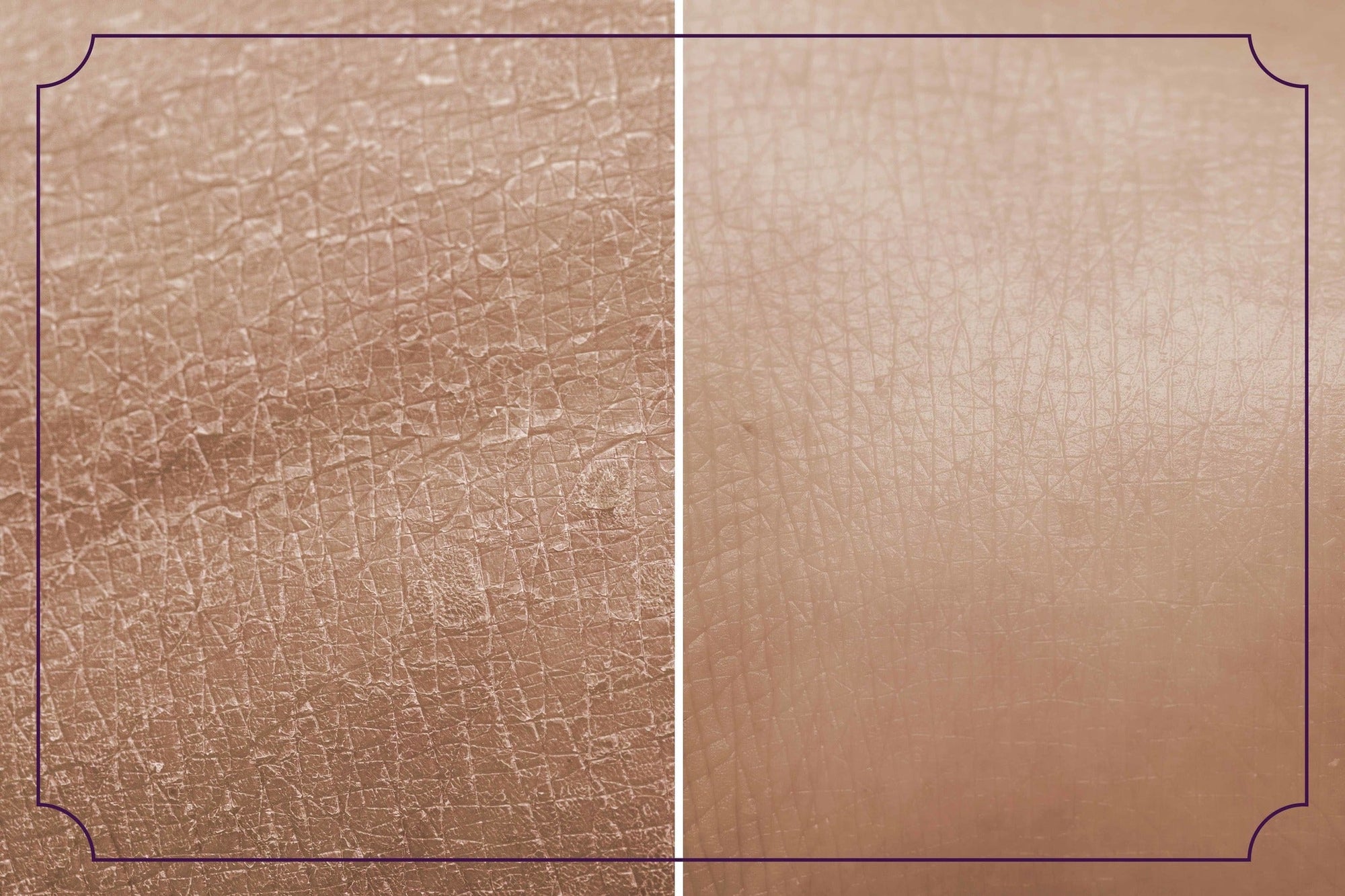 Science of Hydration: Powerful Essential Vitamins for Radiant and Blissful Skin